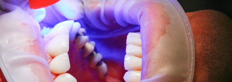 Kieferorthopäde Kieferorthopäde