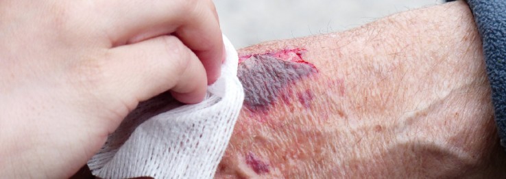 Desinfektion Desinfektion