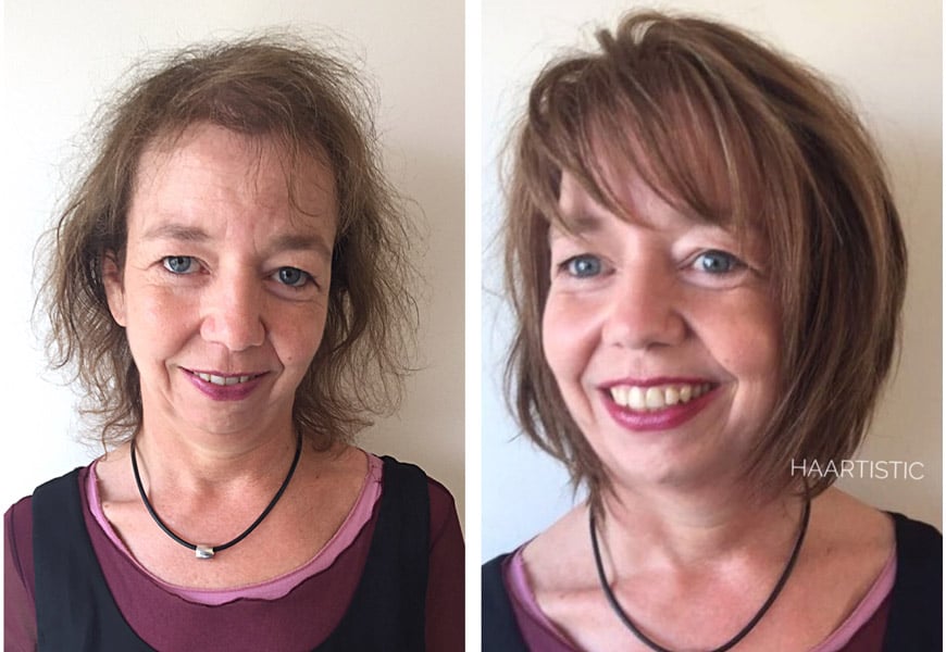 Haartistic-Friseur-Hilden-Haarverdichtung-vorher-nachher-Beispiel